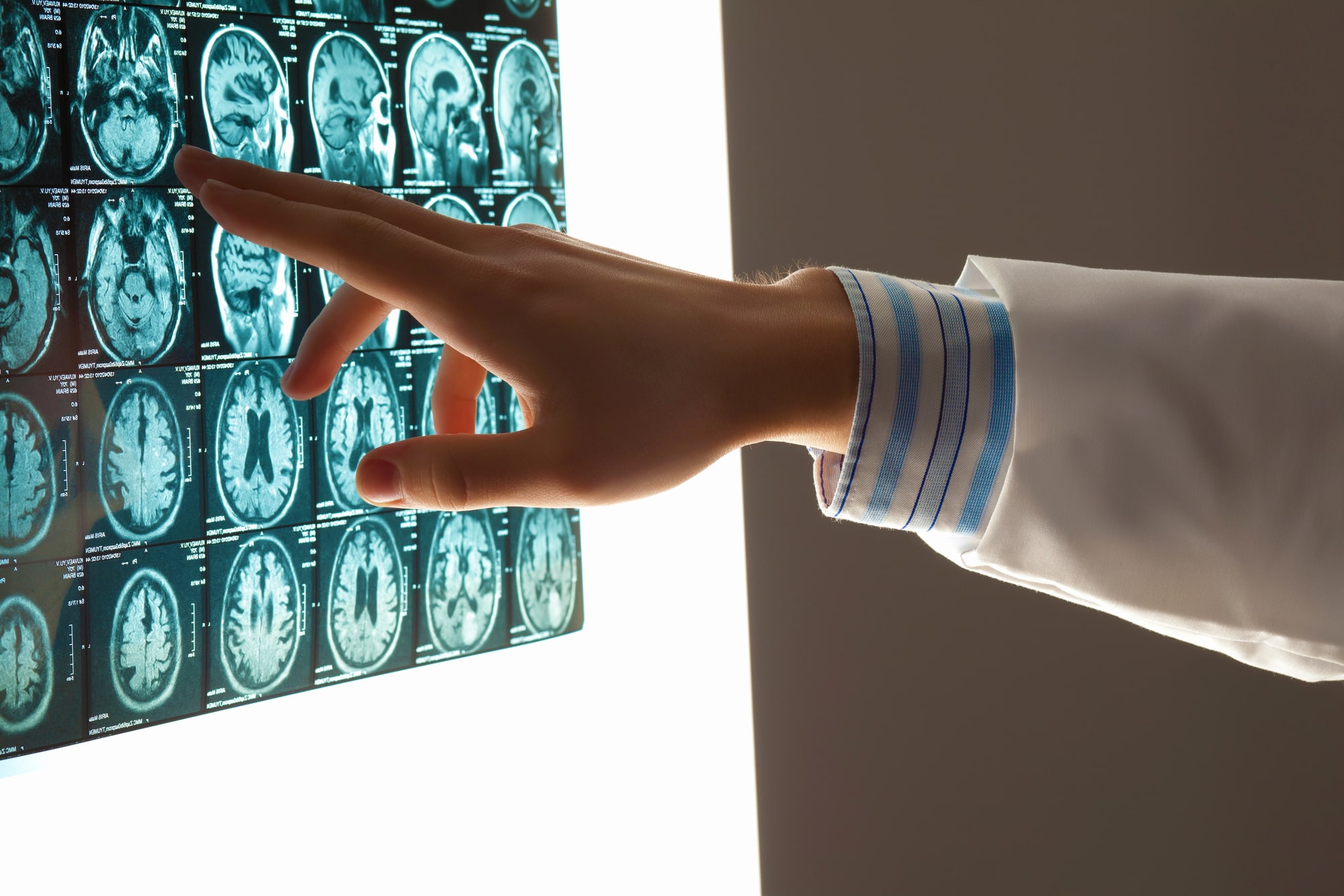 brain injury lawyer Paradise, NV